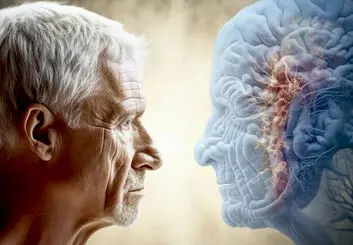 کاهش وزن، مغز را حداقل ۹ ماه جوان‌تر می‌کند