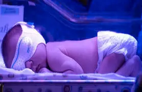 ساخت حسگر پوشیدنی هوشمند بومی برای تشخیص زردی نوزادان
