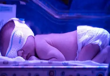 ساخت حسگر پوشیدنی هوشمند بومی برای تشخیص زردی نوزادان
