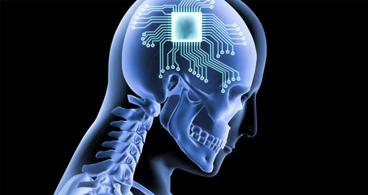 اتصال اعصاب نخاعی آسیب دیده به کمک هوش مصنوعی