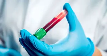 آزمایش خون جدید با یک بار نمونه گیری به تشخیص بیماری های متعدد کمک می کند