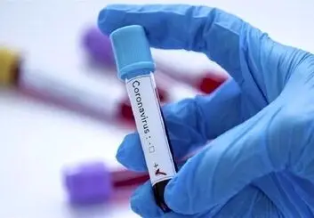 نحوه رسیدگی به ویروس کرونا مورد اعتراض دانشجویان دانشگاه علوم‌ پزشکی تهران است