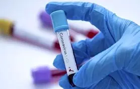 نحوه رسیدگی به ویروس کرونا مورد اعتراض دانشجویان دانشگاه علوم‌ پزشکی تهران است