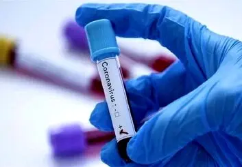 نحوه رسیدگی به ویروس کرونا مورد اعتراض دانشجویان دانشگاه علوم‌ پزشکی تهران است