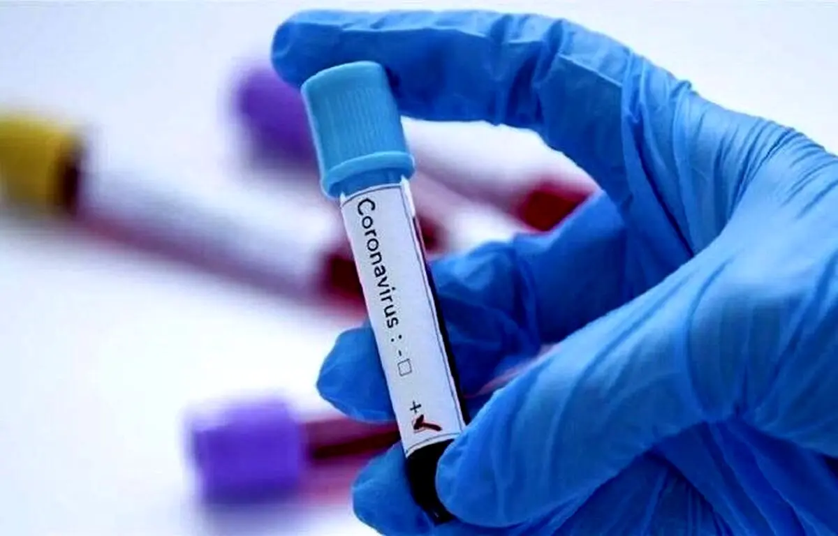 نحوه رسیدگی به ویروس کرونا مورد اعتراض دانشجویان دانشگاه علوم‌ پزشکی تهران است