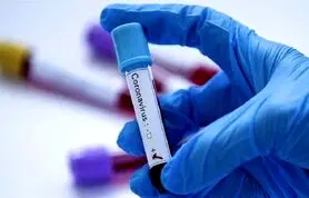 نحوه رسیدگی به ویروس کرونا مورد اعتراض دانشجویان دانشگاه علوم‌ پزشکی تهران است
