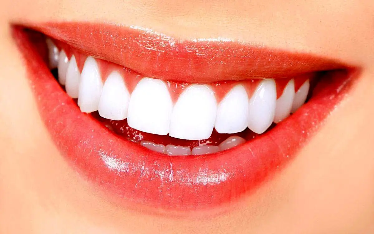 آیا طراحی لبخند برای همه افراد مناسب است؟

