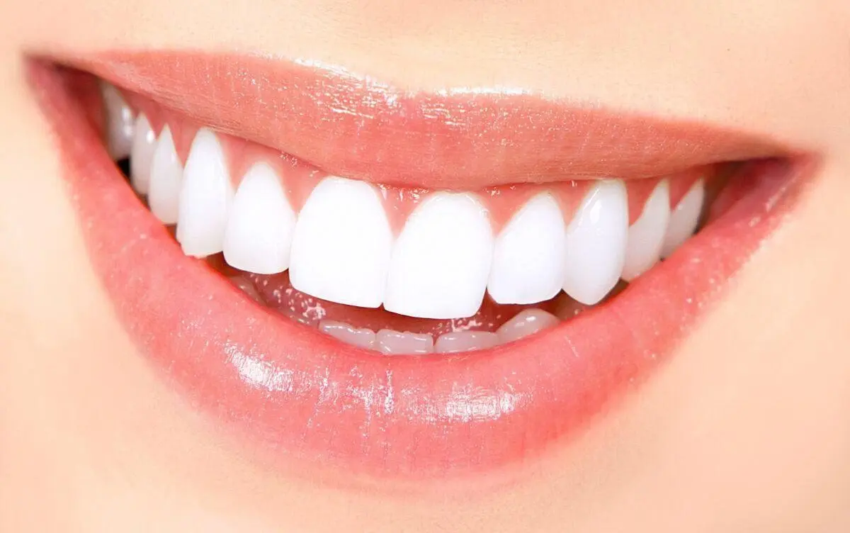 آیا طراحی لبخند برای همه افراد مناسب است؟


