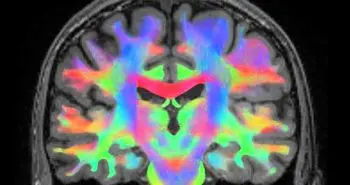 ظرفیت حافظه انسان معادل با حافظه ۳۱ هزار آیفون ۷s!