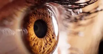 القای توهم بصری توسط مغز