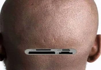 ساخت یک پروتز کاشتنی در مغز برای تقویت هوش و حافظه