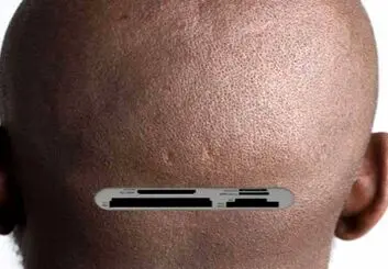 ساخت یک پروتز کاشتنی در مغز برای تقویت هوش و حافظه