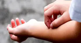 چرا خارش مسری است؟