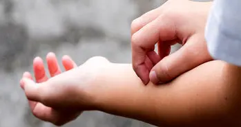 چرا خارش مسری است؟