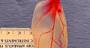 جاری شدن خون در مویرگ های برگ اسفناج