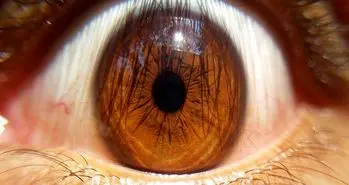 روش جدیدی در عمل پیوند شبکیه چشم با استفاده از سلول های بنیادی