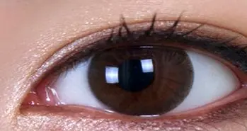 ایمپلنت مصنوعی شبکیه چشم؛ گامی مهم در درمان کوری