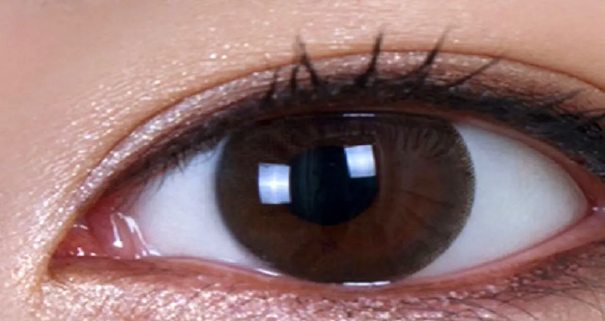 ایمپلنت مصنوعی شبکیه چشم؛ گامی مهم در درمان کوری