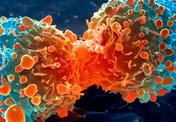 نخستین روش مبارزه با سرطان تایید شد