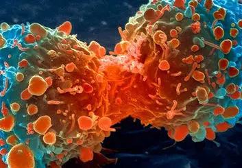 نخستین روش مبارزه با سرطان تایید شد