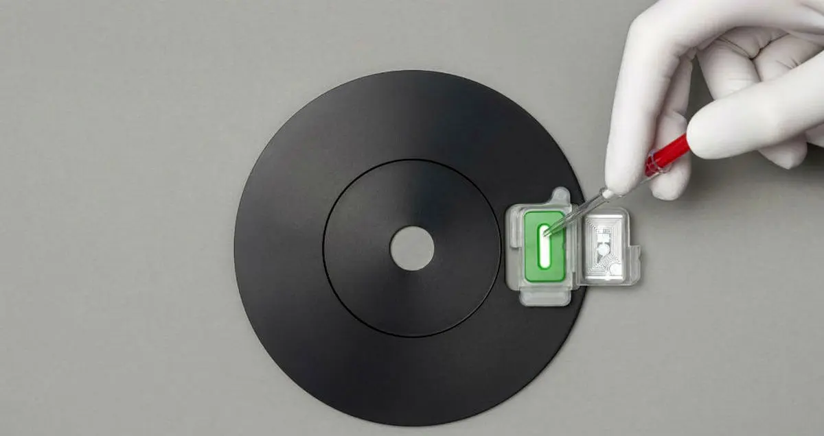 abioSCOPE ظرف ۵ دقیقه آلرژی را تشخیص می‌دهد!