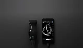 تشخیص دقیق سرطان با استفاده از وسیله جانبی آیفون!