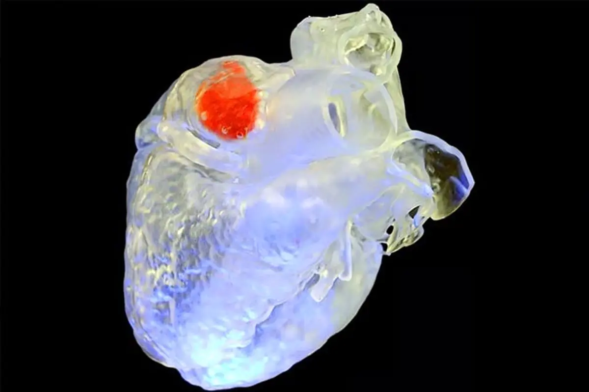 چاپ ۳ بعدی اندام در «داخل بدن» با استفاده از فناوری فراصوت
