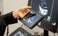iVIZ سونوسایت جدید، اولتراساوند قابل حمل، روانه بازار اروپا شد