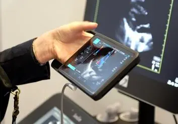 iVIZ سونوسایت جدید، اولتراساوند قابل حمل، روانه بازار اروپا شد