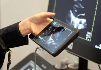 iVIZ سونوسایت جدید، اولتراساوند قابل حمل، روانه بازار اروپا شد