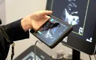 iVIZ سونوسایت جدید، اولتراساوند قابل حمل، روانه بازار اروپا شد