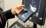 iVIZ سونوسایت جدید، اولتراساوند قابل حمل، روانه بازار اروپا شد