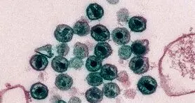 درمان ایدز با استفاده از پیوند سلول های بنیادی برای دومین بار!