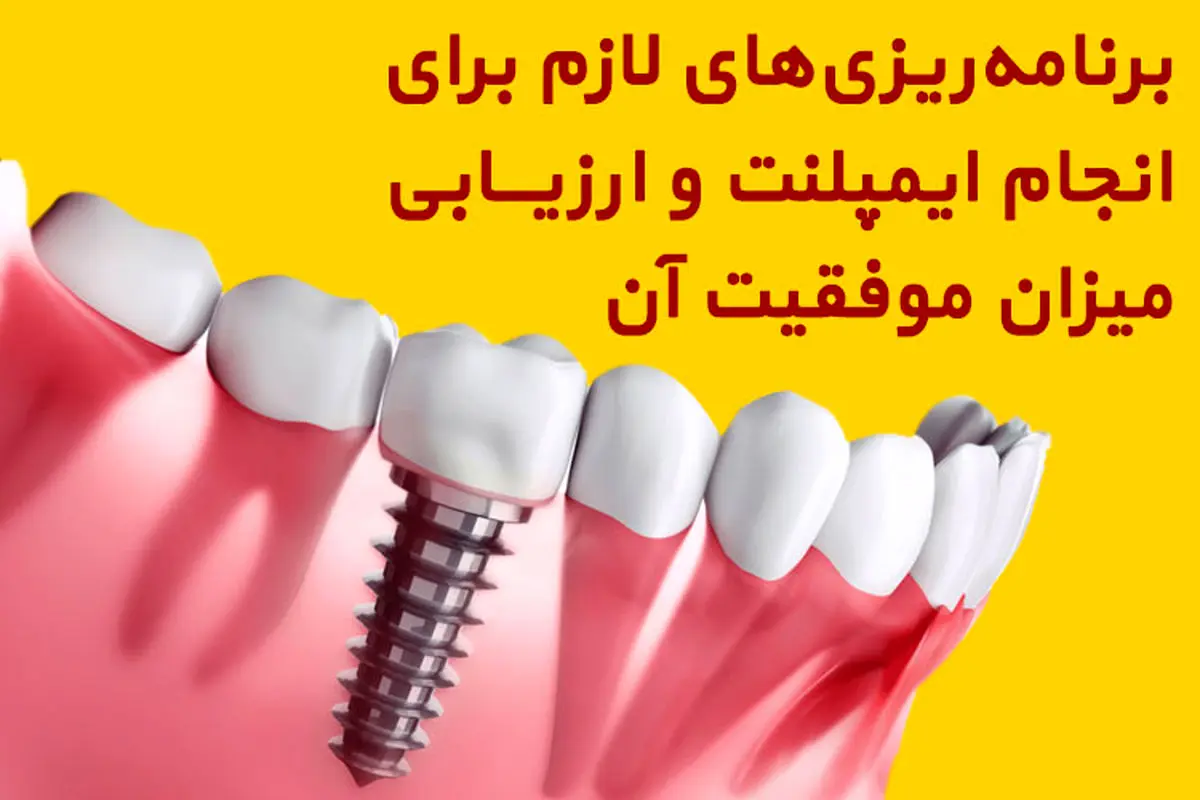 برنامه‌ریزی‌های لازم برای انجام ایمپلنت و ارزیابی میزان موفقیت آن