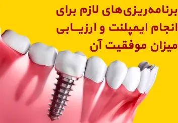 برنامه‌ریزی‌های لازم برای انجام ایمپلنت و ارزیابی میزان موفقیت آن