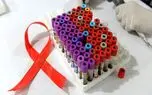 دانشمندان موفق به حذف ویروس HIV از DNA یک موش شدند