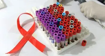 دانشمندان موفق به حذف ویروس HIV از DNA یک موش شدند