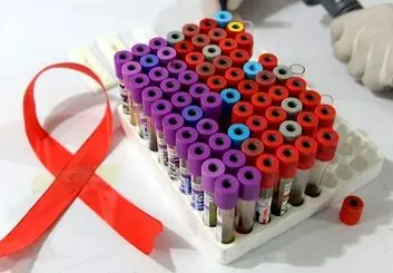 دانشمندان موفق به حذف ویروس HIV از DNA یک موش شدند
