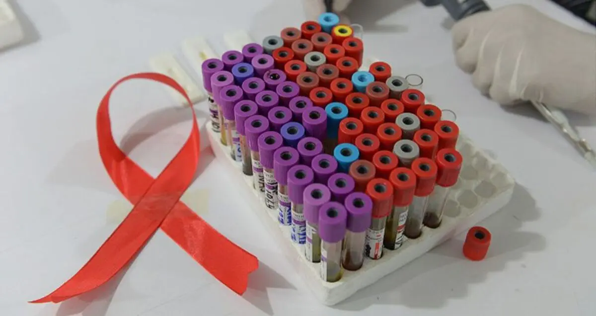 دانشمندان موفق به حذف ویروس HIV از DNA یک موش شدند