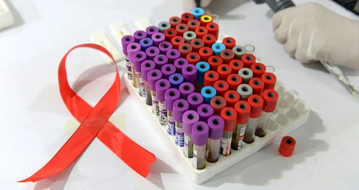 دانشمندان موفق به حذف ویروس HIV از DNA یک موش شدند