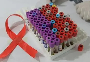 دانشمندان موفق به حذف ویروس HIV از DNA یک موش شدند