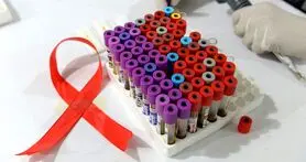 دانشمندان موفق به حذف ویروس HIV از DNA یک موش شدند