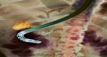 الیمپوس لوازم پزشکی آلوده وارد بازار کرد