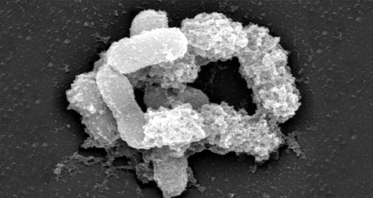 بهبود علائم بیماری ALS با استفاده از یک نوع باکتری