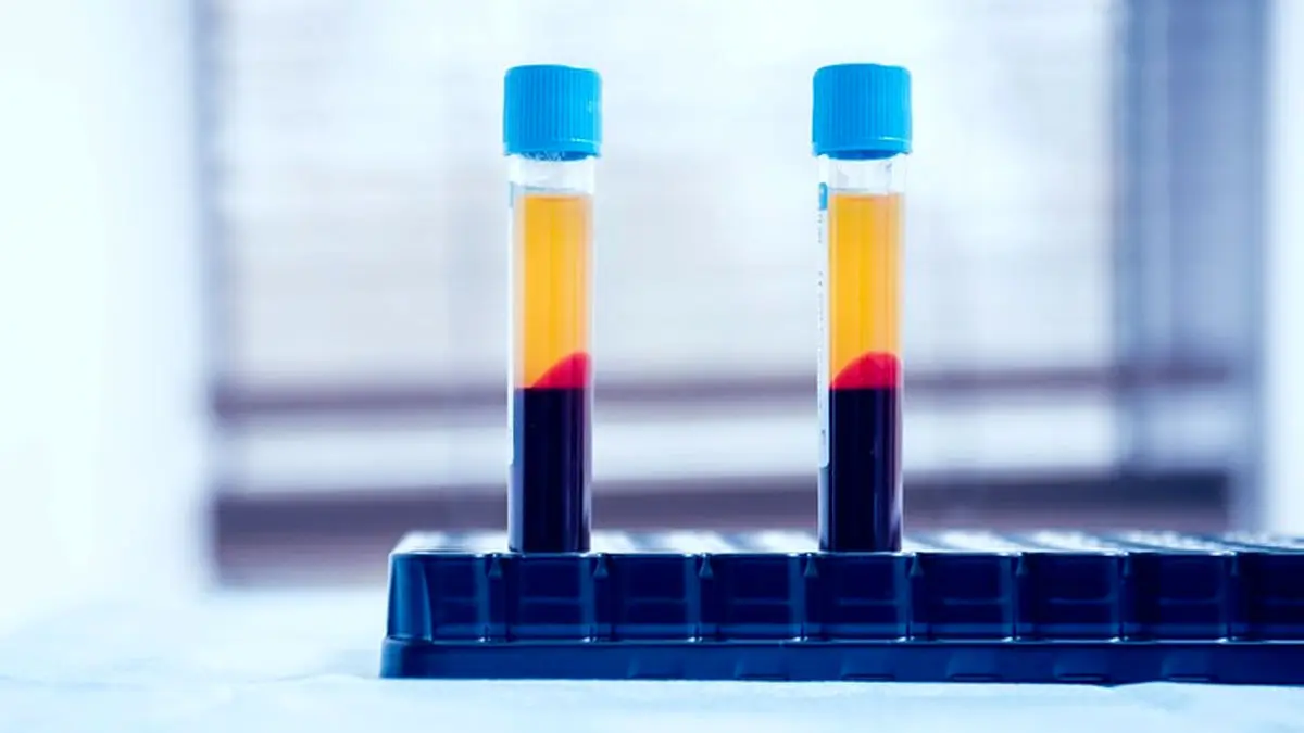 مایکروسافت خون می‌خرد؛ پرداخت 250 دلار برای اهدای خون بیماران کرونایی