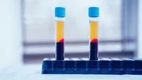 مایکروسافت خون می‌خرد؛ پرداخت 250 دلار برای اهدای خون بیماران کرونایی