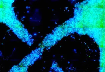 تولید بافت های گیاهی چوبی و فیبری در آزمایشگاه