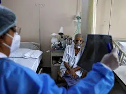 شیوع قارچ سیاه در تهران | قارچ سیاه چیست و چه علائمی دارد؟