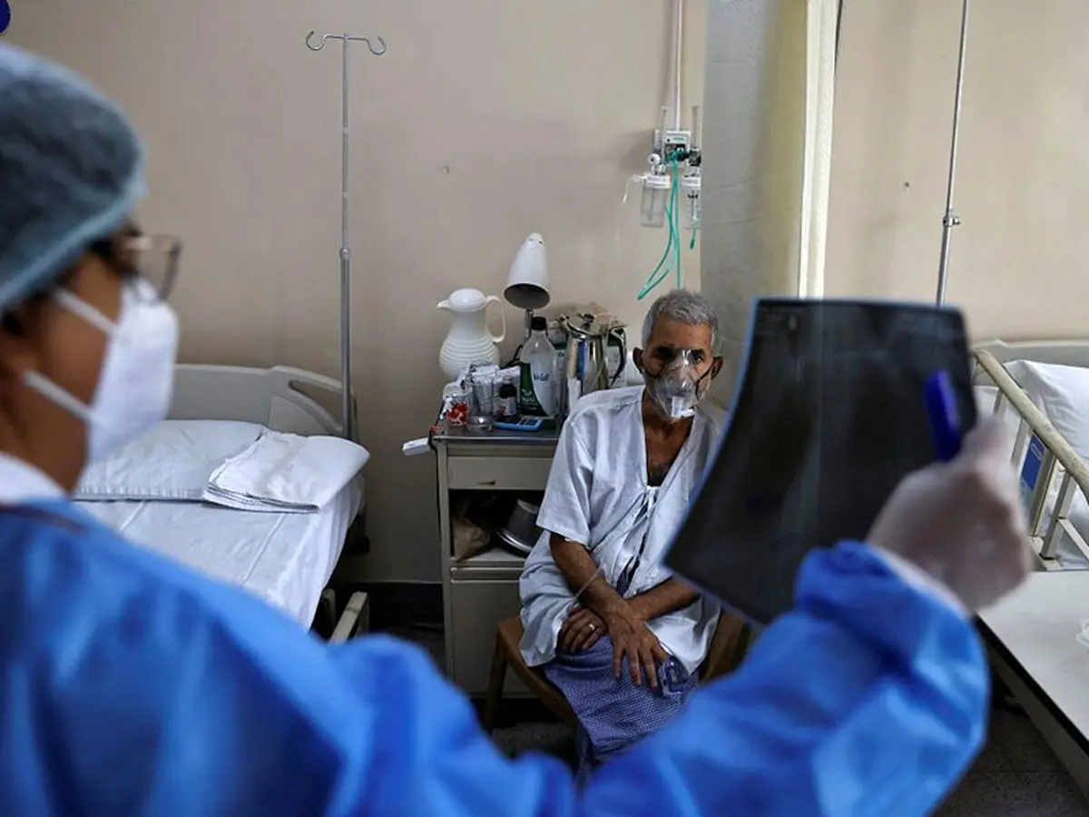 شیوع قارچ سیاه در تهران | قارچ سیاه چیست و چه علائمی دارد؟