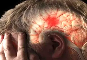 سکته مغزی در کمین افراد کم‌تحرک | بدن به چند ساعت فعالیت در هفته نیاز دارد؟
